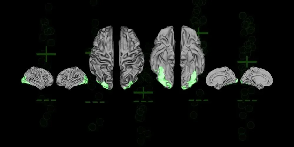 brain scans from different angles