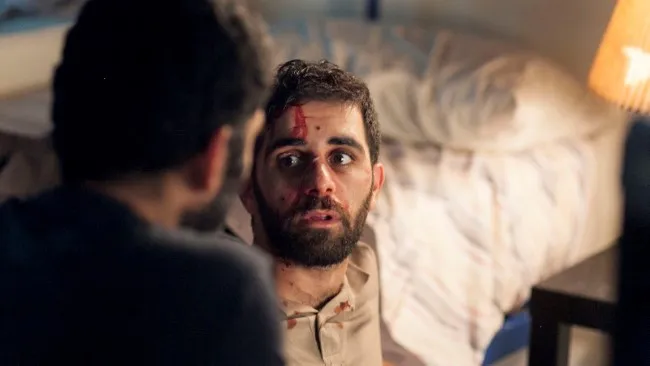 A beaten man with blood on his face